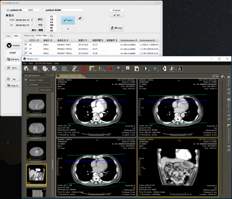 conquest dicom: conquest dicom server – FTLN